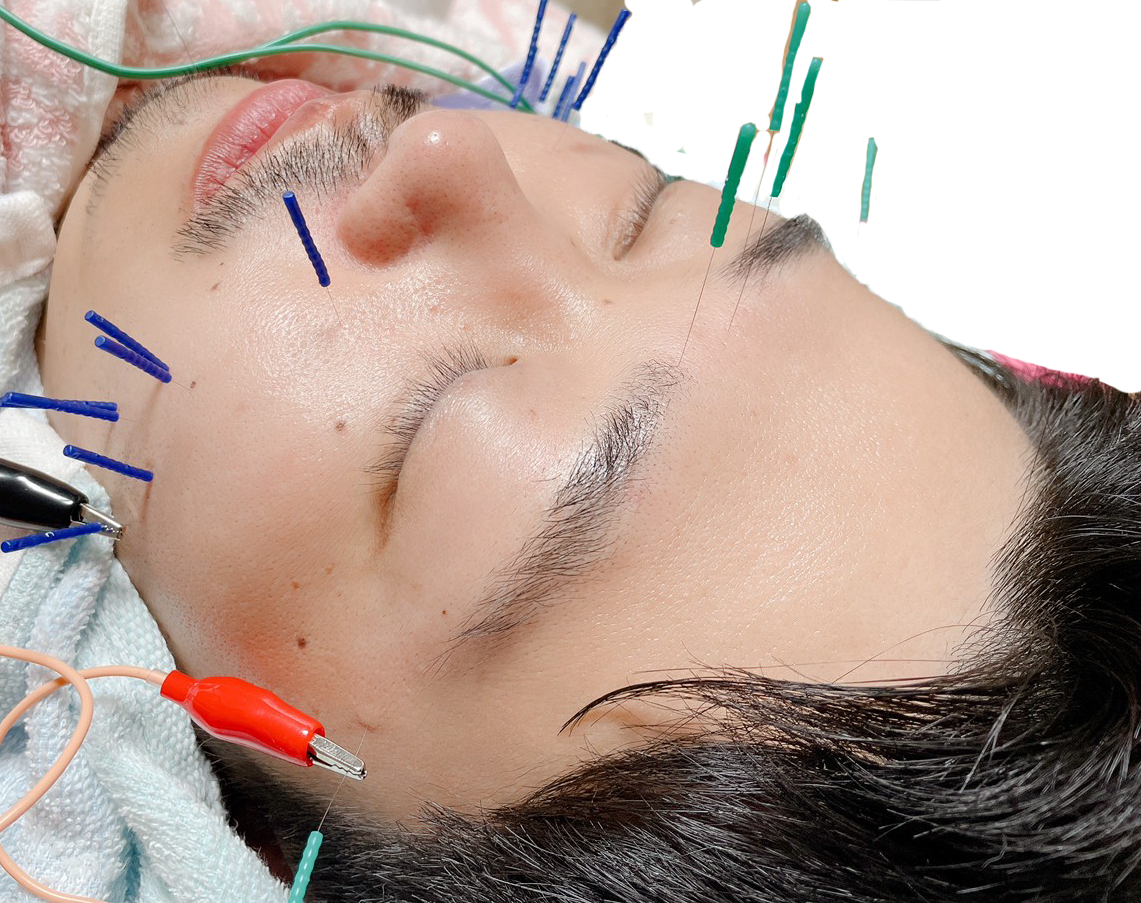 顔に針を刺している様子